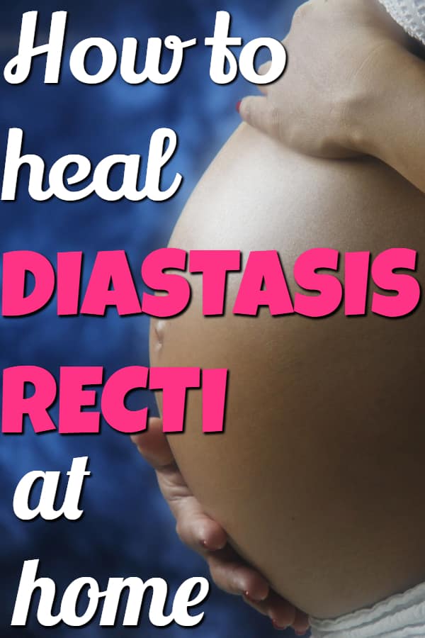 How to heal diastasis recti at home with these postpartum exercises #diastasisrecti #diastasisrectiexercises